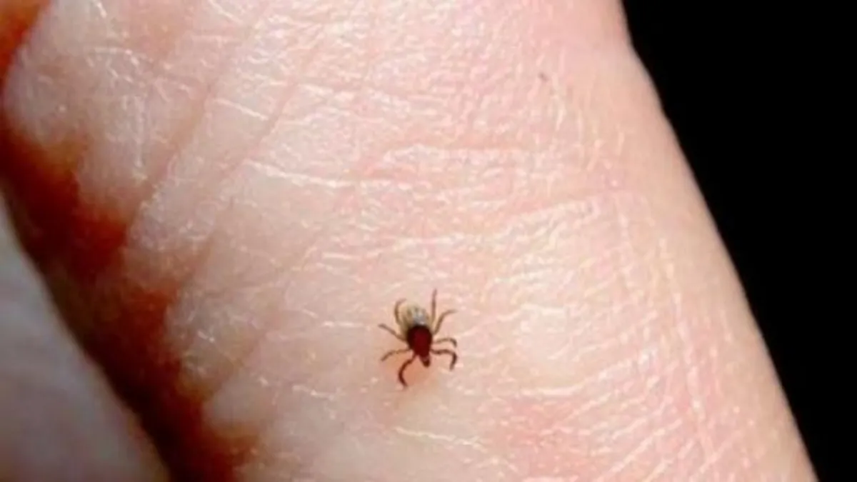 Aunque los casos de rickettsia han aumentado en Sinaloa durante 2025, la tasa de mortalidad no ha crecido.