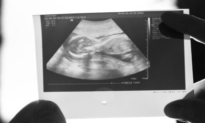 SESNSP registra 80 denuncias por aborto en Baja California en 2022 y 2023